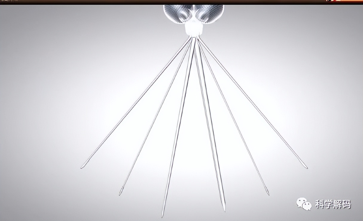 蚊子的嘴解剖,蚊子的内脏解剖照片