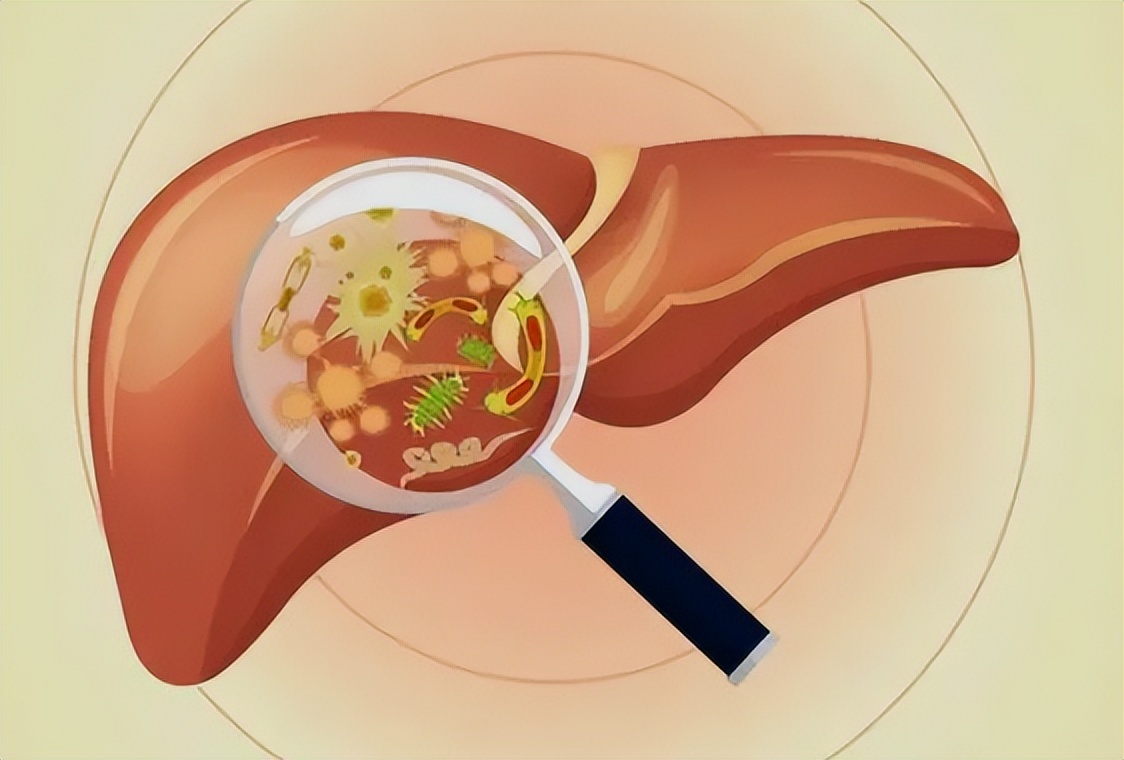 精子变黄的病因,精子变黄有什么症状