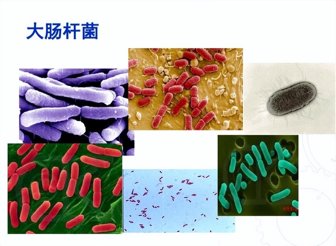 尿路感染最常见的致病菌有哪些,发生尿路感染最常见的感染途径是