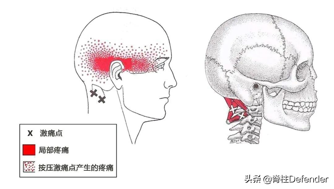 脖子肩膀酸痛的有效缓解方法,最近脖子两侧颈肩酸痛