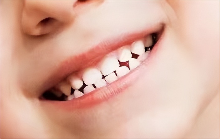 宝宝牙缝有点大这是好还是坏呢,为什么宝宝的牙缝很大