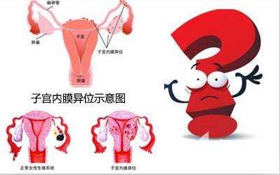 备孕时期，左等右等宝宝总不来，可能是被堵在输卵管了