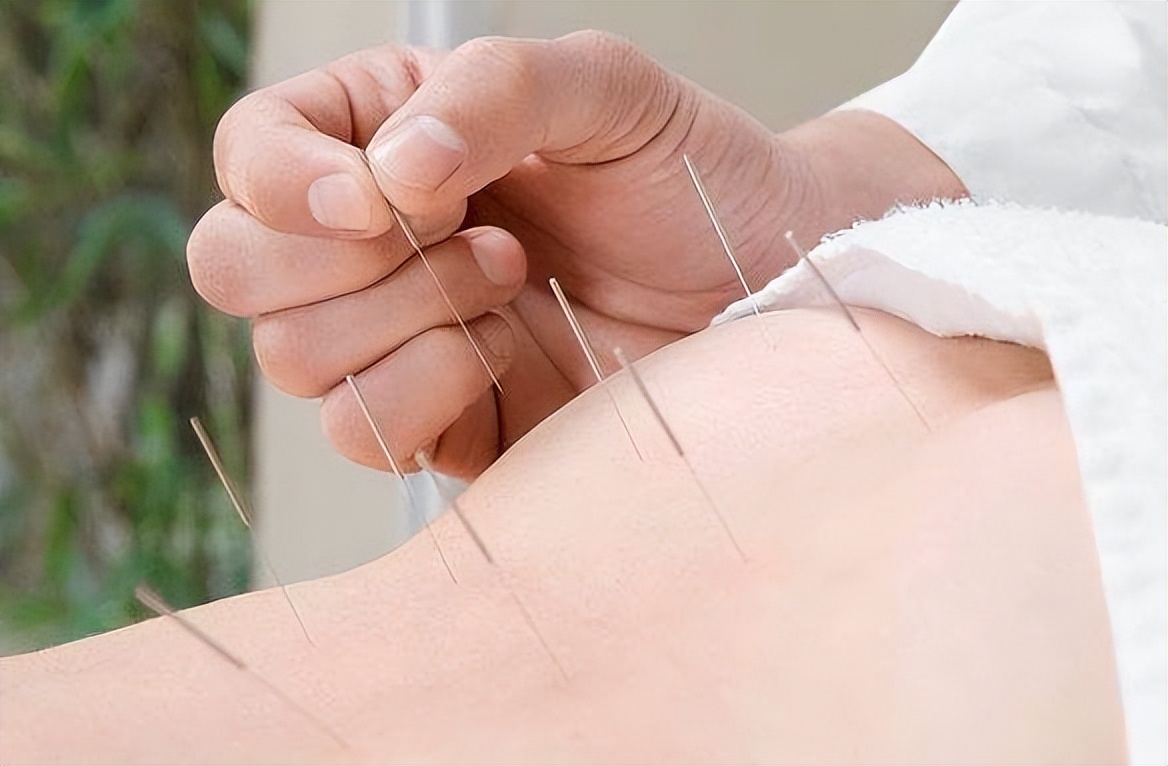 盘点那些年交过的智商税——减肥产品