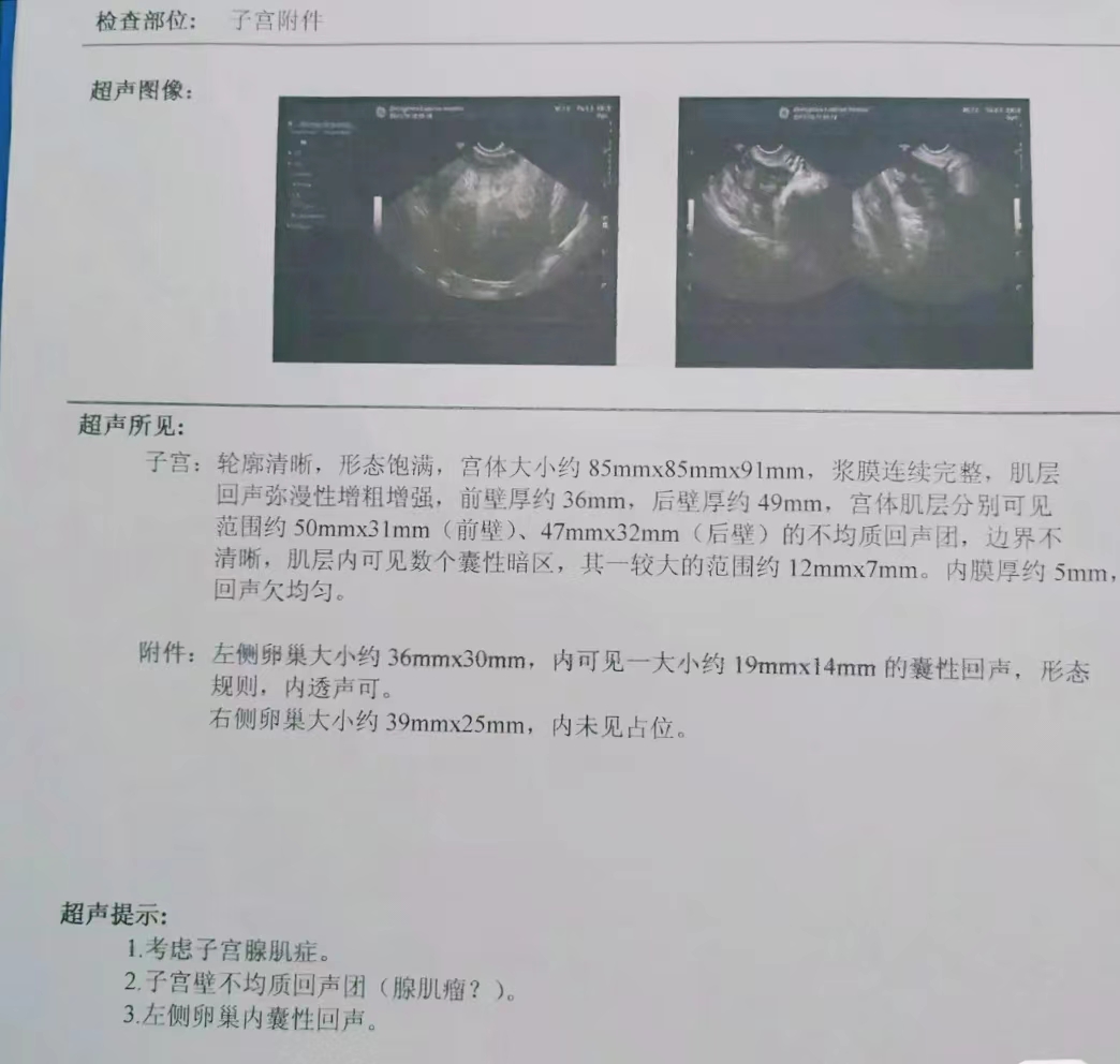 苏小姐发现自己意外怀孕了,腺肌症怀孕保胎能保住吗