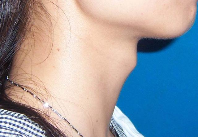 男生喉结与女生喉结有什么区别,为什么男生有喉结而女生没有
