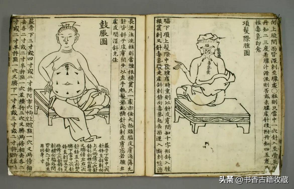 【中医秘本】《治肿指南》