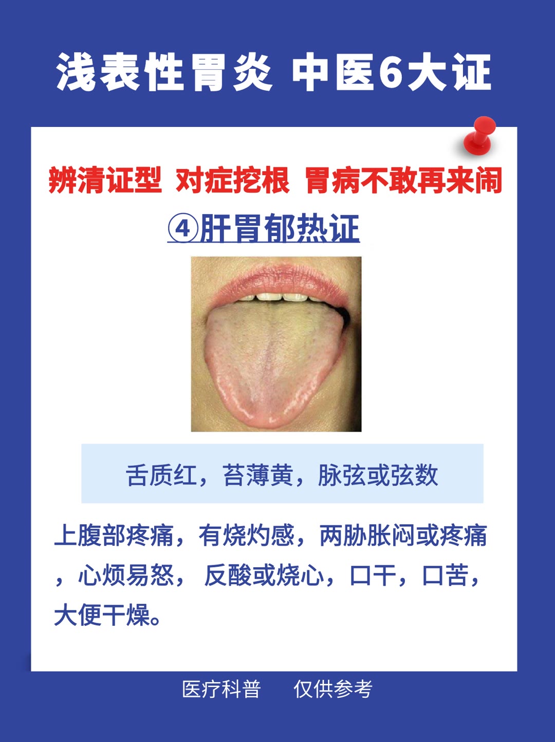 慢性浅表性胃炎中医治疗药方,浅表性胃炎中医判断