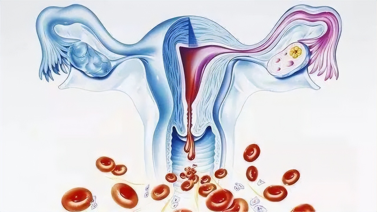 节育环在女性体内，会发生哪些变化？30年前上环的女性有哪些结局