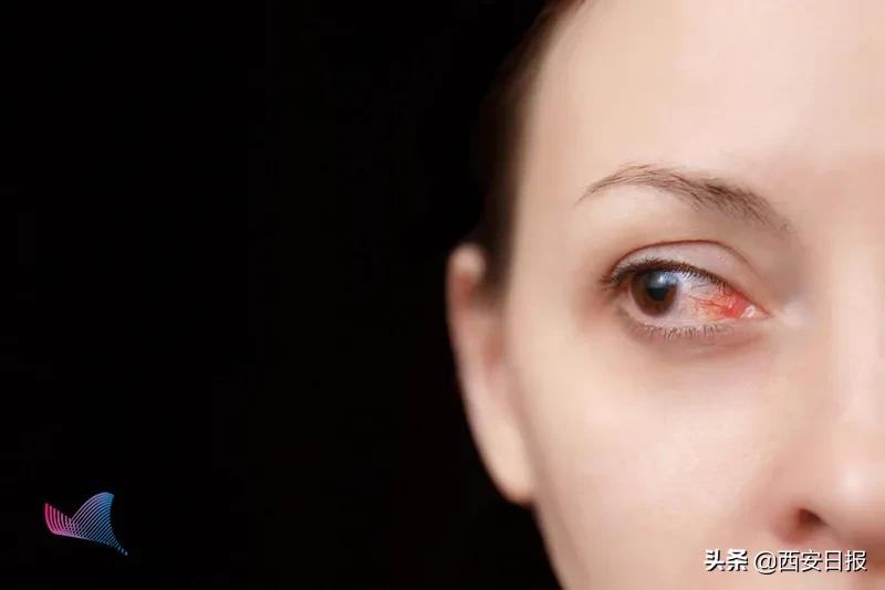 几块钱一支的红霉素眼膏，到底能治多少病？答案来了