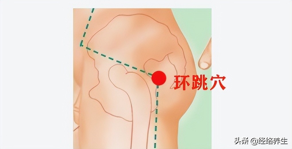 坐骨神经痛影响走路怎么办,坐骨神经痛后果严重吗
