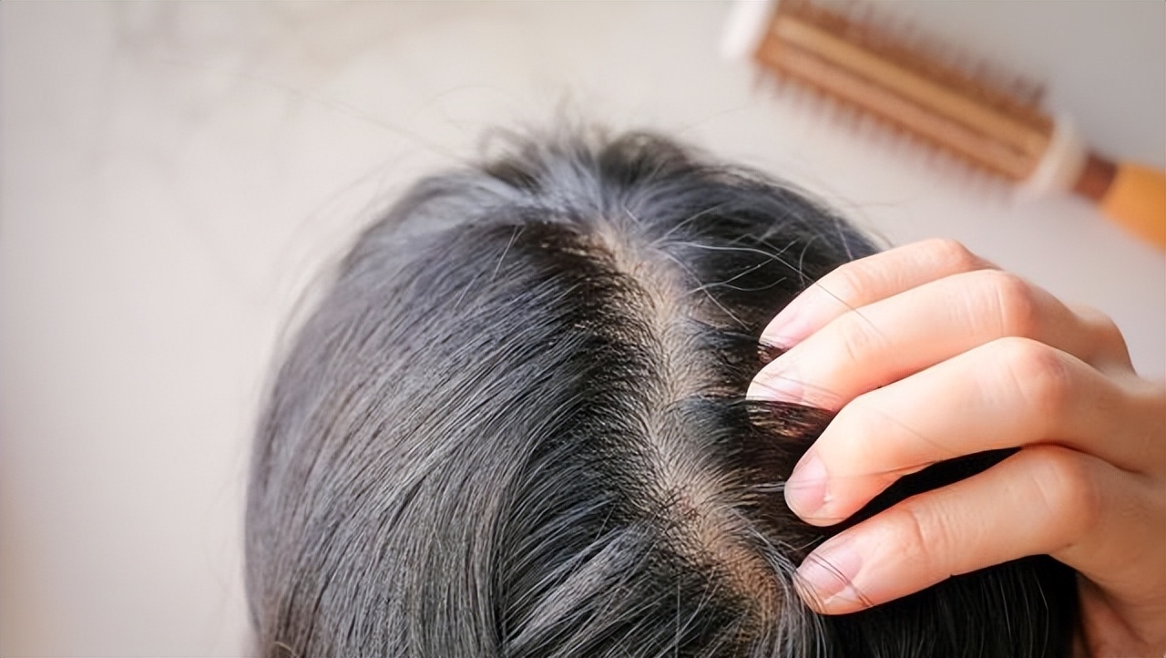 有白发不要急着染,有了白发的人要注意什么