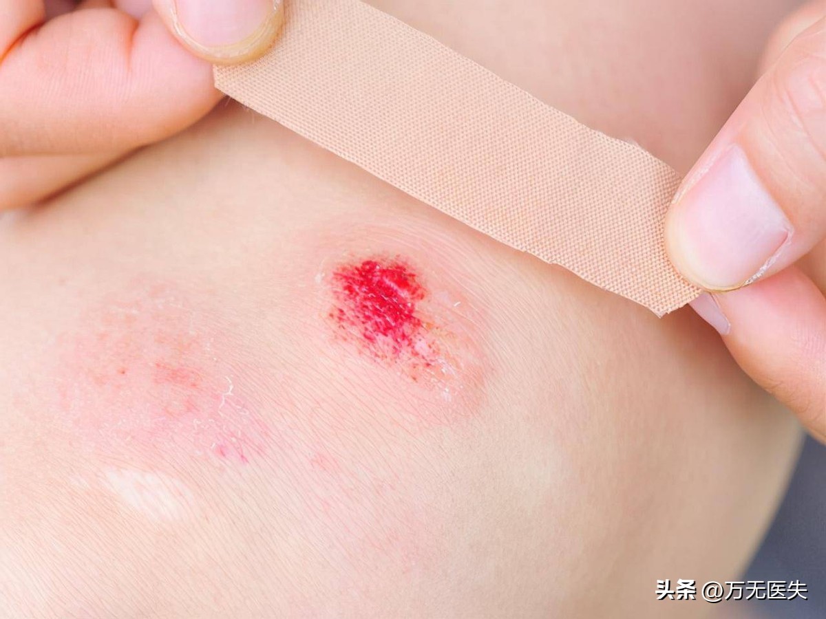 常吃冷饭降血脂吗,经常吃冷饭对人体有害吗