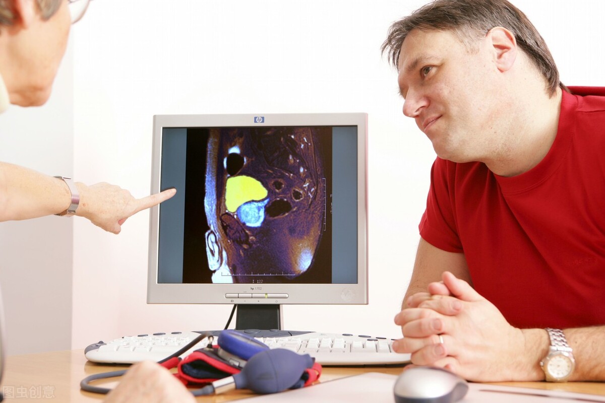 治疗前列腺非那雄胺片哪个牌子好,前列腺长期吃非那雄胺有副作用吗