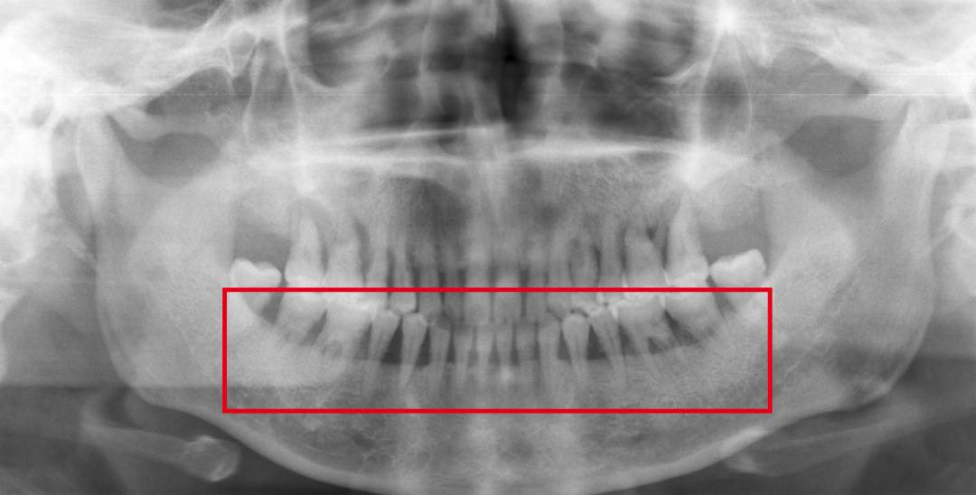 老是牙龈出血该吃什么药,牙龈老是出血不管行不行