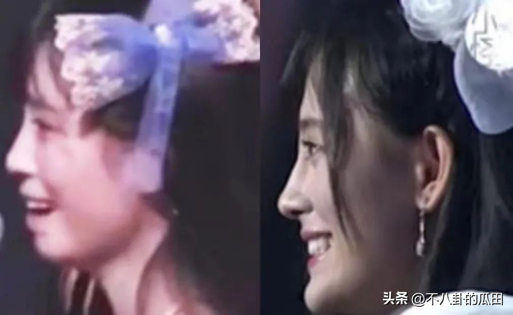 蔡徐坤下巴太尖惹争议图片,蔡徐坤下巴是假体吗