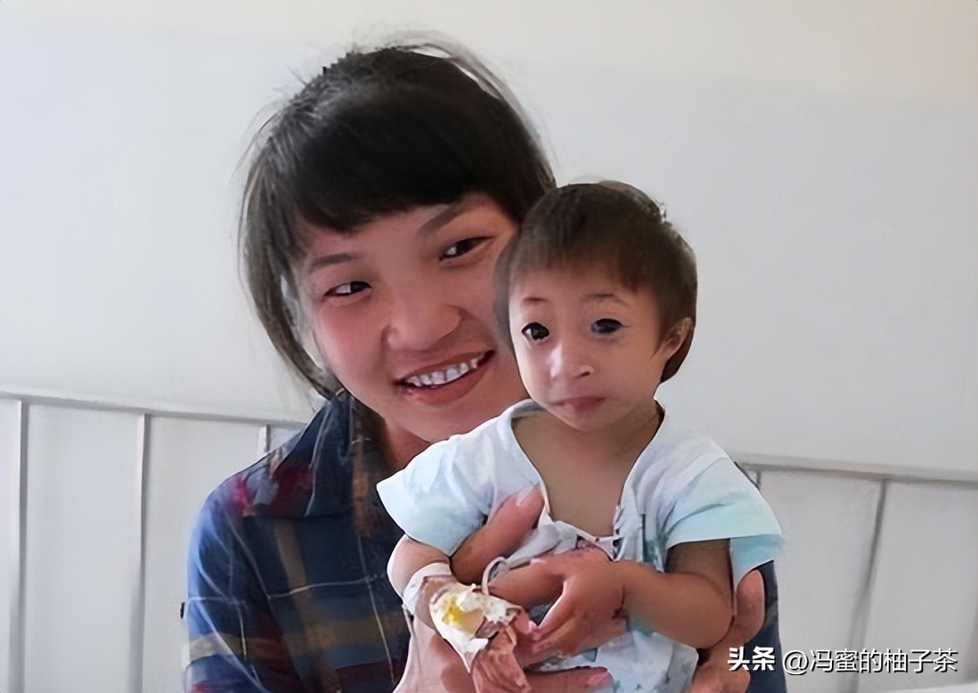 2009年湖南女子生下重2斤小猴子,湖南女子生了个小猴子上综艺节目