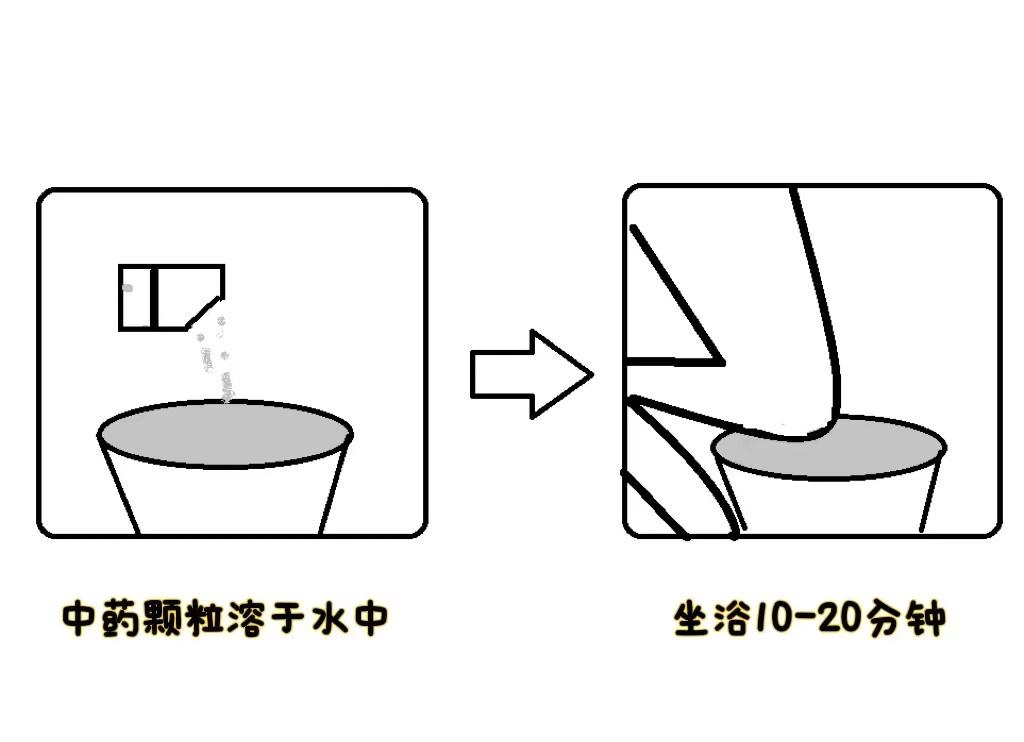 痔疮跟肛周脓肿的区别中医怎么讲,肛周肿痛误为痔疮