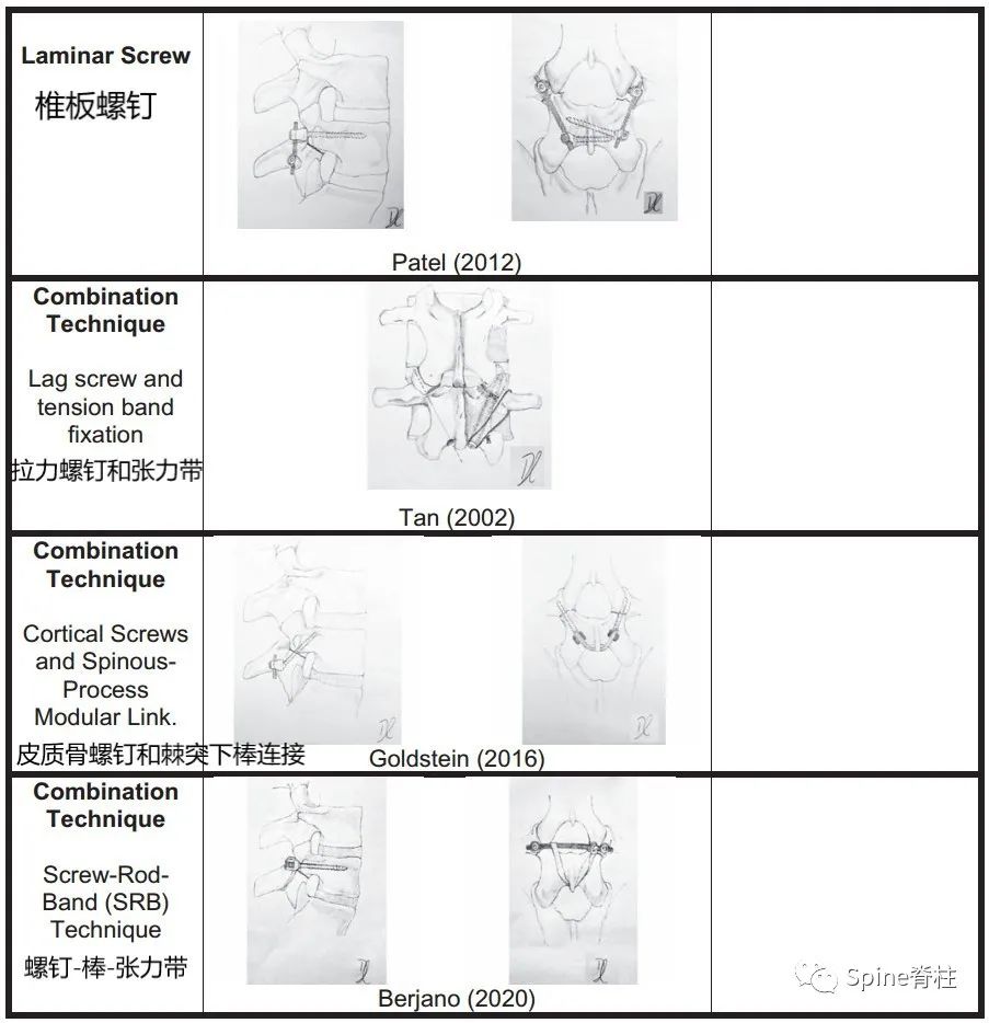 轻度峡部裂和重度峡部裂的区别,真性峡部裂和假性峡部裂