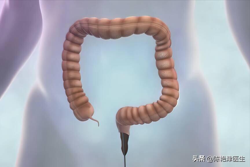 为什么不愿意做肠镜,为啥很多人不愿做肠镜检查