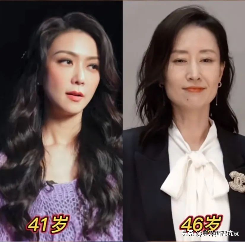 中庭长怎么避免显老,中庭长怎么改善