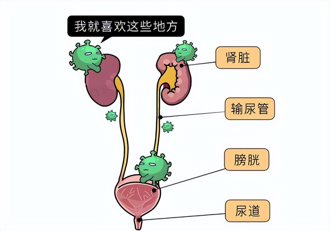 医院内尿路感染常见的诱因,尿路感染最严重的后果