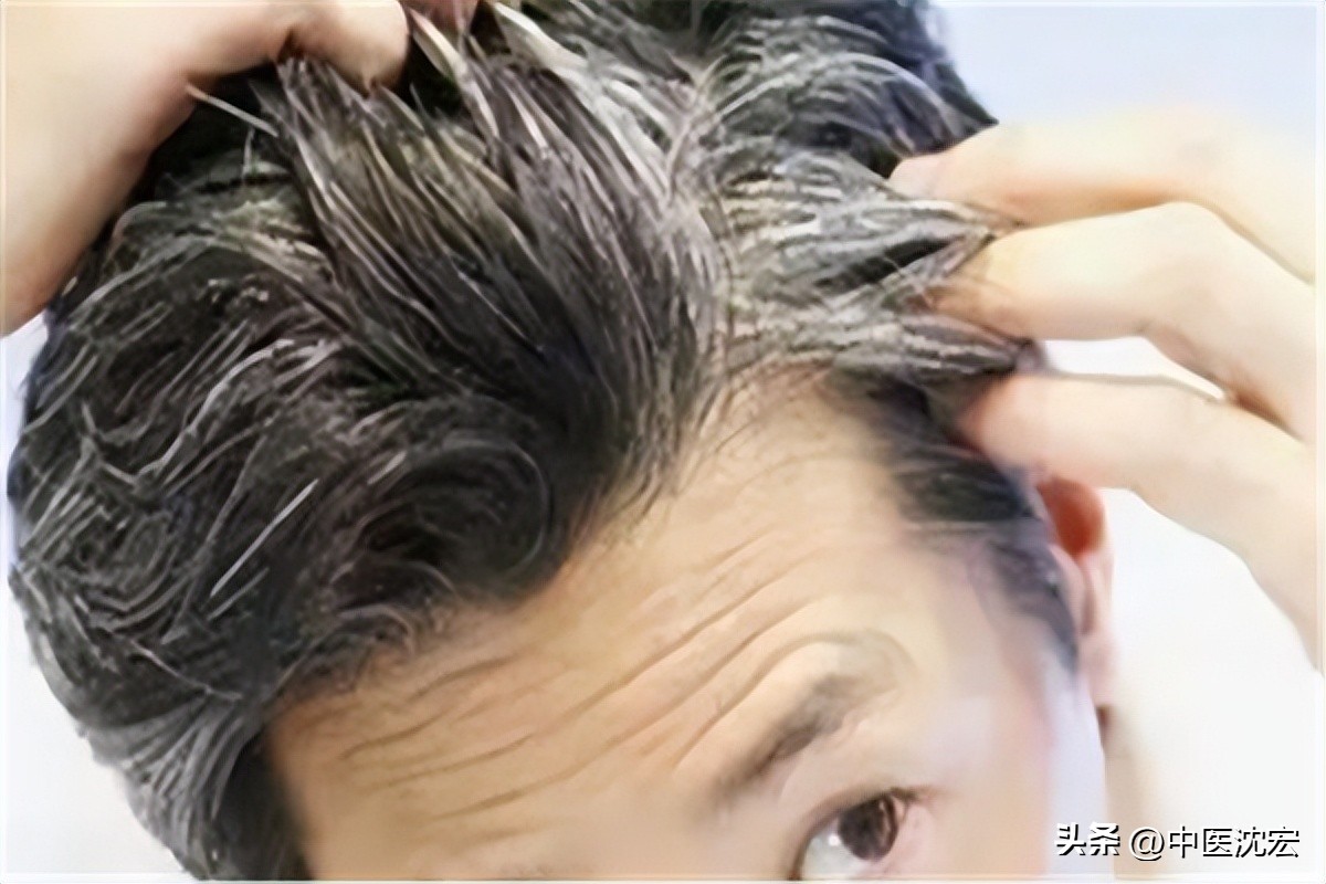 中医界的万能方逍遥丸,一代名方逍遥丸