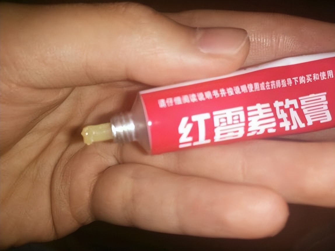 红霉素和金霉素软膏的作用和功效,红霉素软膏和红霉素眼膏作用功效
