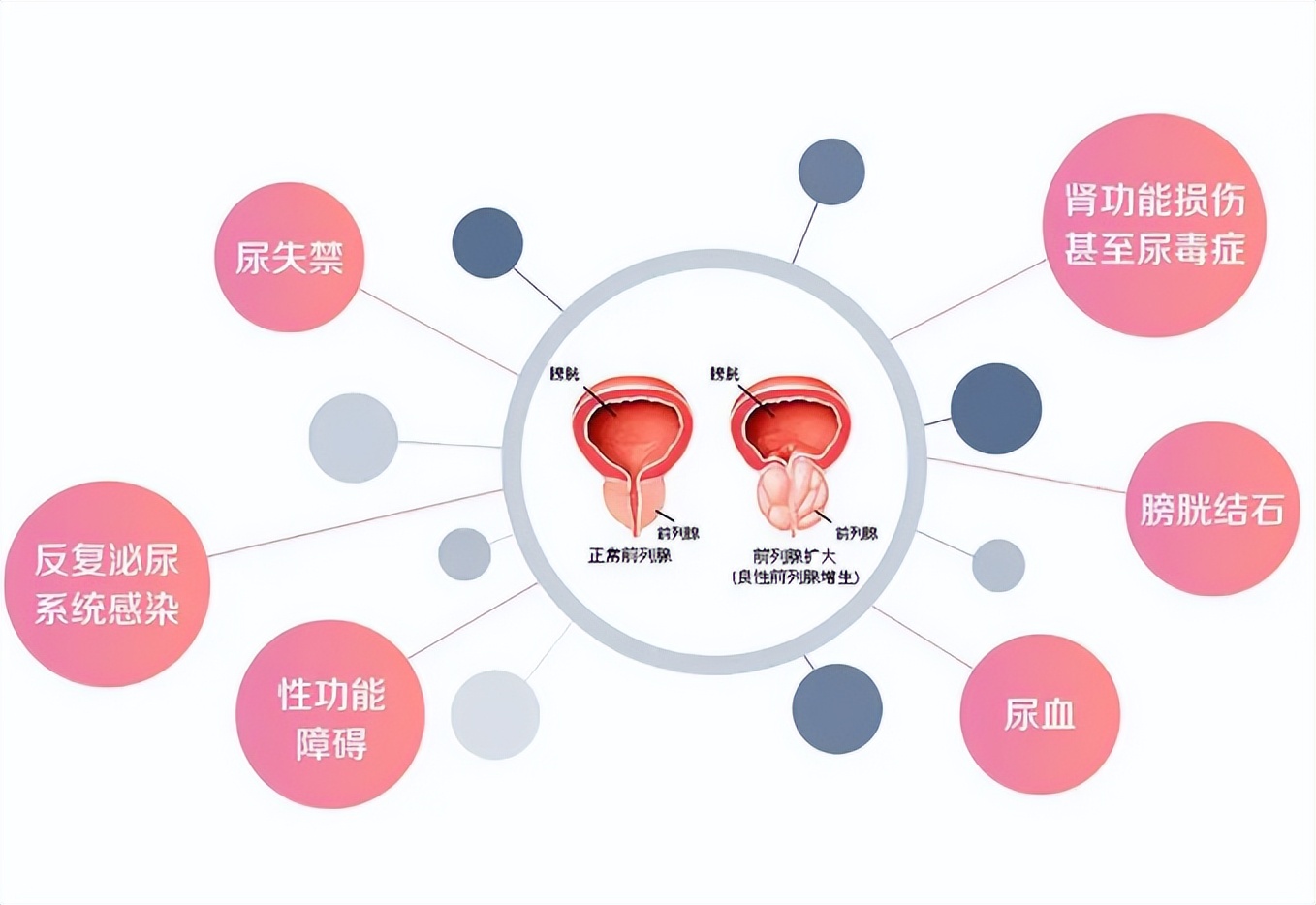 小便一次尿不尽跟气虚有关吗,尿不尽补肾气吃什么