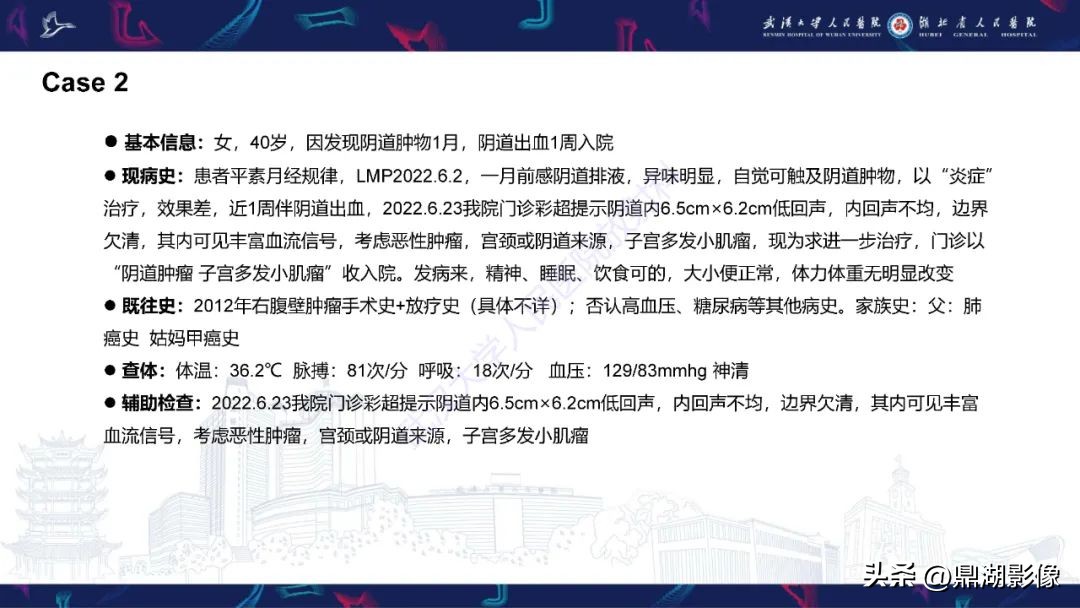 阴道肉瘤的早期症状,阴道里长肉瘤是啥症状