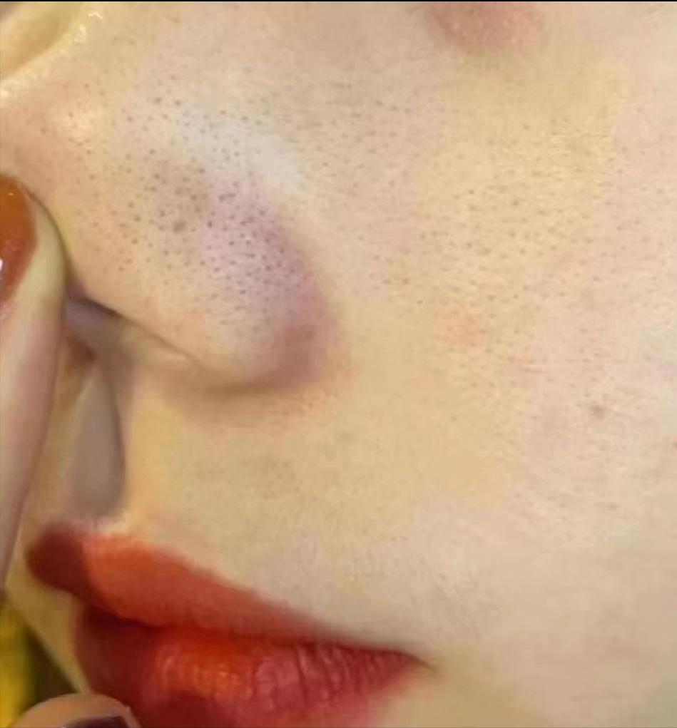 抗衰祛皱纹逆龄变美,紧致抗衰淡法令纹的项目