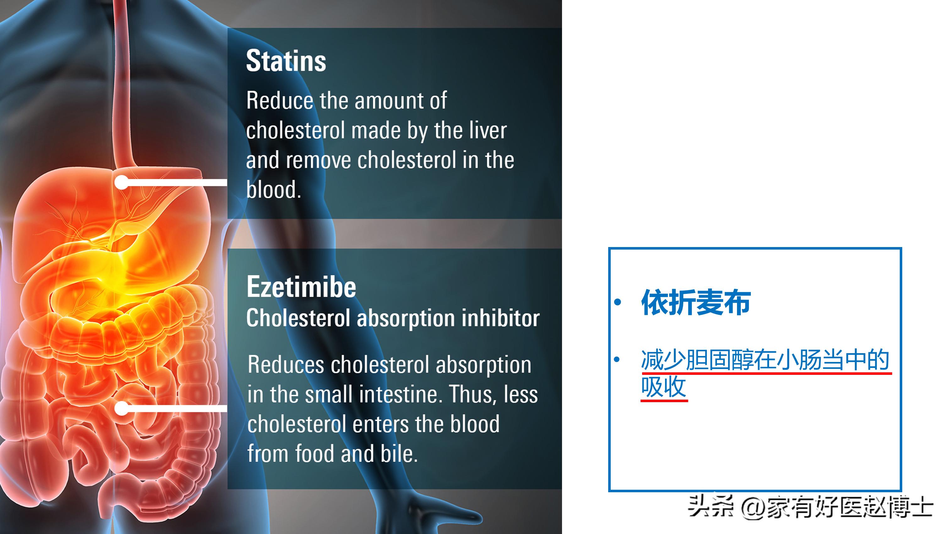服用他汀类降脂药时牢记三不要,血脂1.1不吃他汀吃血脂康可以吗