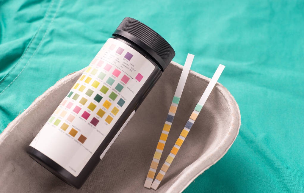 痛风需要长期碱化尿液吗,碳酸氢钠碱化尿液注意事项