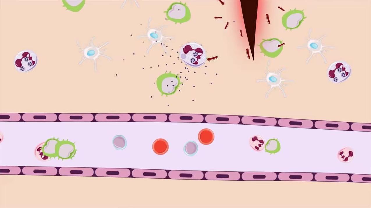 阿莫西林都是消炎药吗,阿莫西林是最好的消炎药了吗