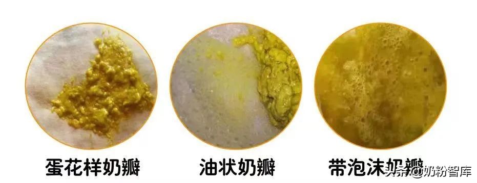 转奶出现绿便还要继续转奶吗,转奶期间出现绿便还要继续转奶吗