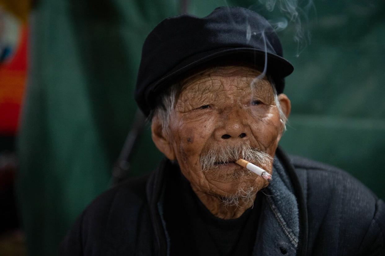 牙膏治疗老年斑小妙招,用生姜和牙膏祛老年斑哪个好