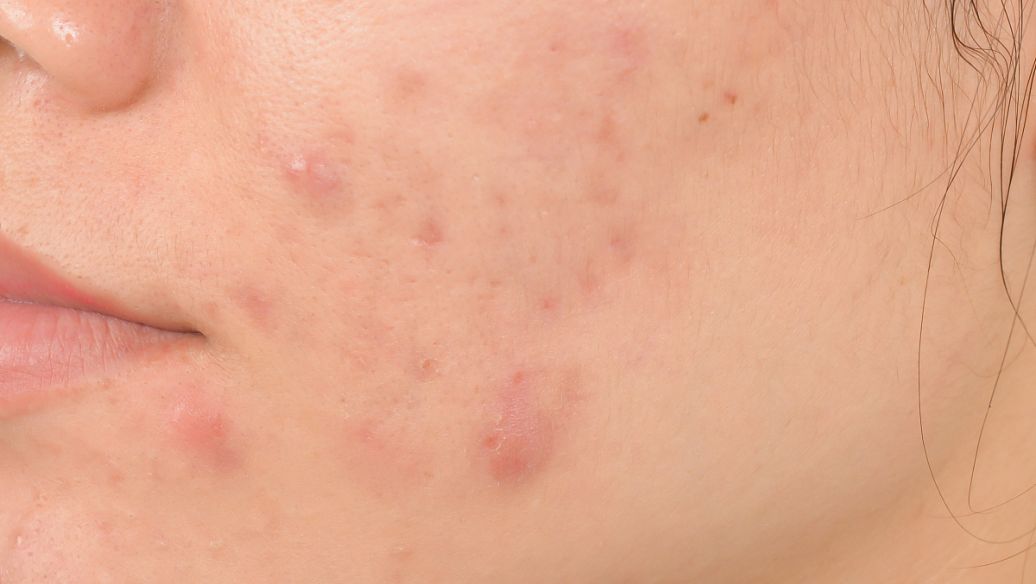 吃知了猴会上火吗好处与坏处,经常吃知了猴对身体有害吗