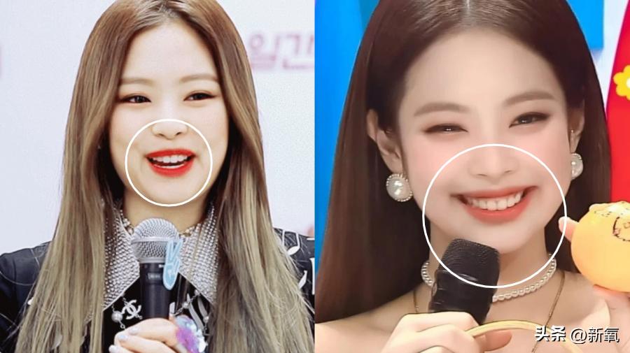 6位一大笑颜值就会崩塌的女明星,看起来笑的很魔性的女明星