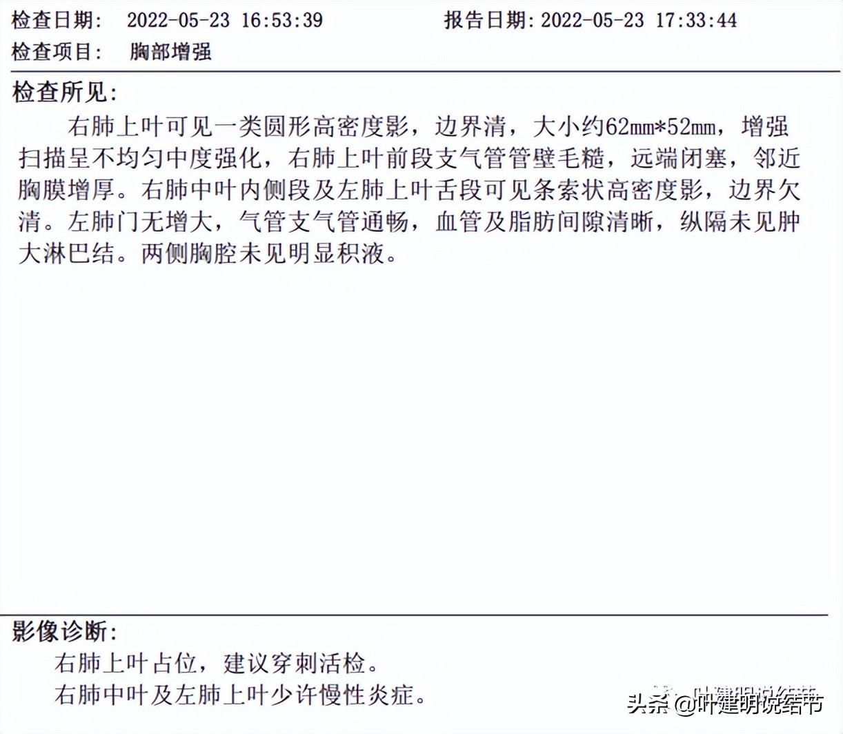 经验：肺占位超6厘米，不是癌还会是什么？临床上仍得多个心眼