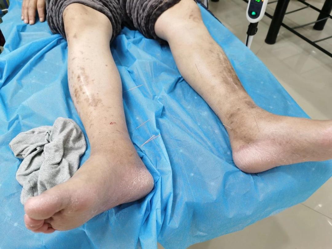 退休老干部看病优先吗,退休老干部可享受哪些医疗待遇