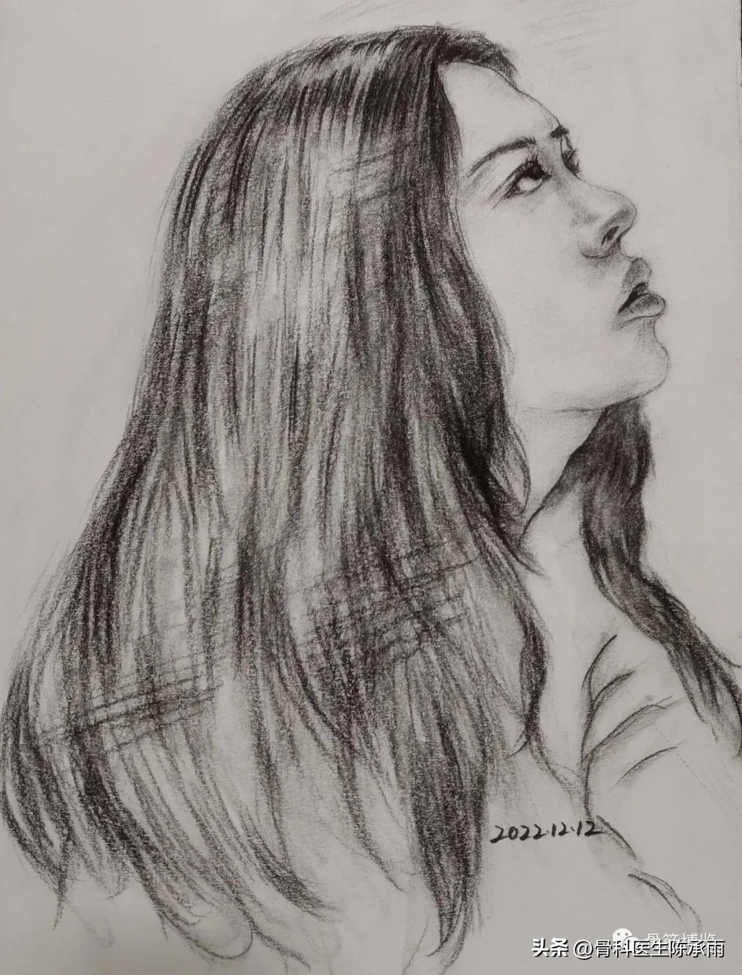 盘状半月板撕裂一级,半月板层裂愈合概率