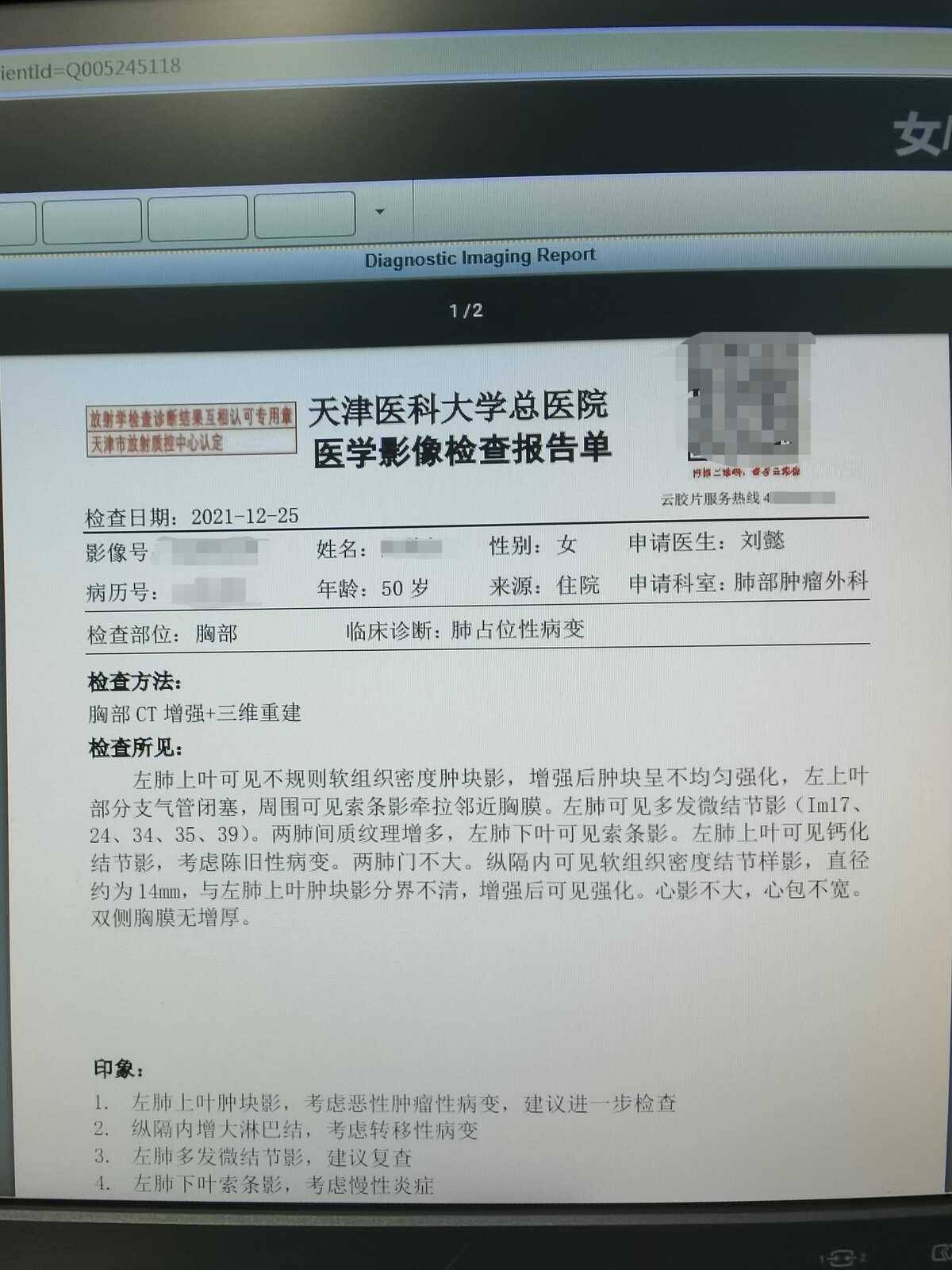 刘懿博士肺癌晚期症状,刘懿博士说肺癌微浸润复发