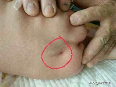 孩子6岁了老是尿床怎么办,男孩4岁尿床脊椎裂