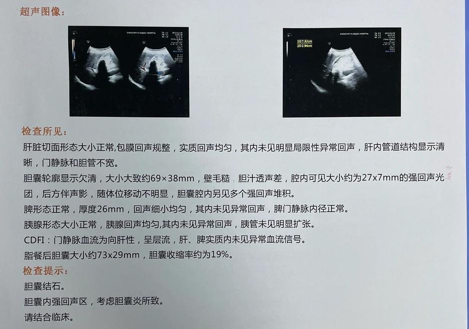 胆囊结石为什么夜间痛,胆囊结石疼痛为何多数在夜间发作