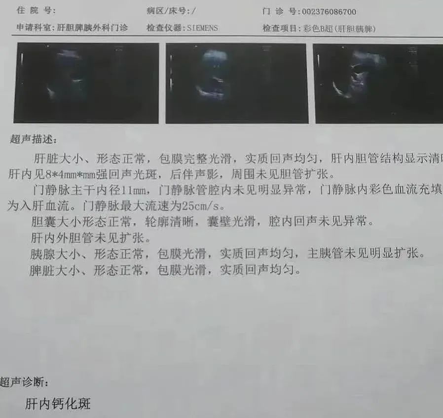 自免肝在中医叫什么病,得了自免肝如何饮食