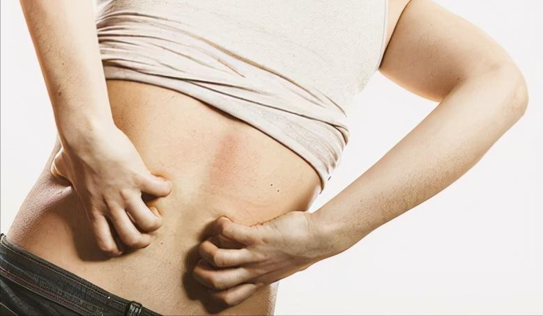 走路跑步后皮肤会痒是什么原因,跑步或走路会身体痒是怎么回事