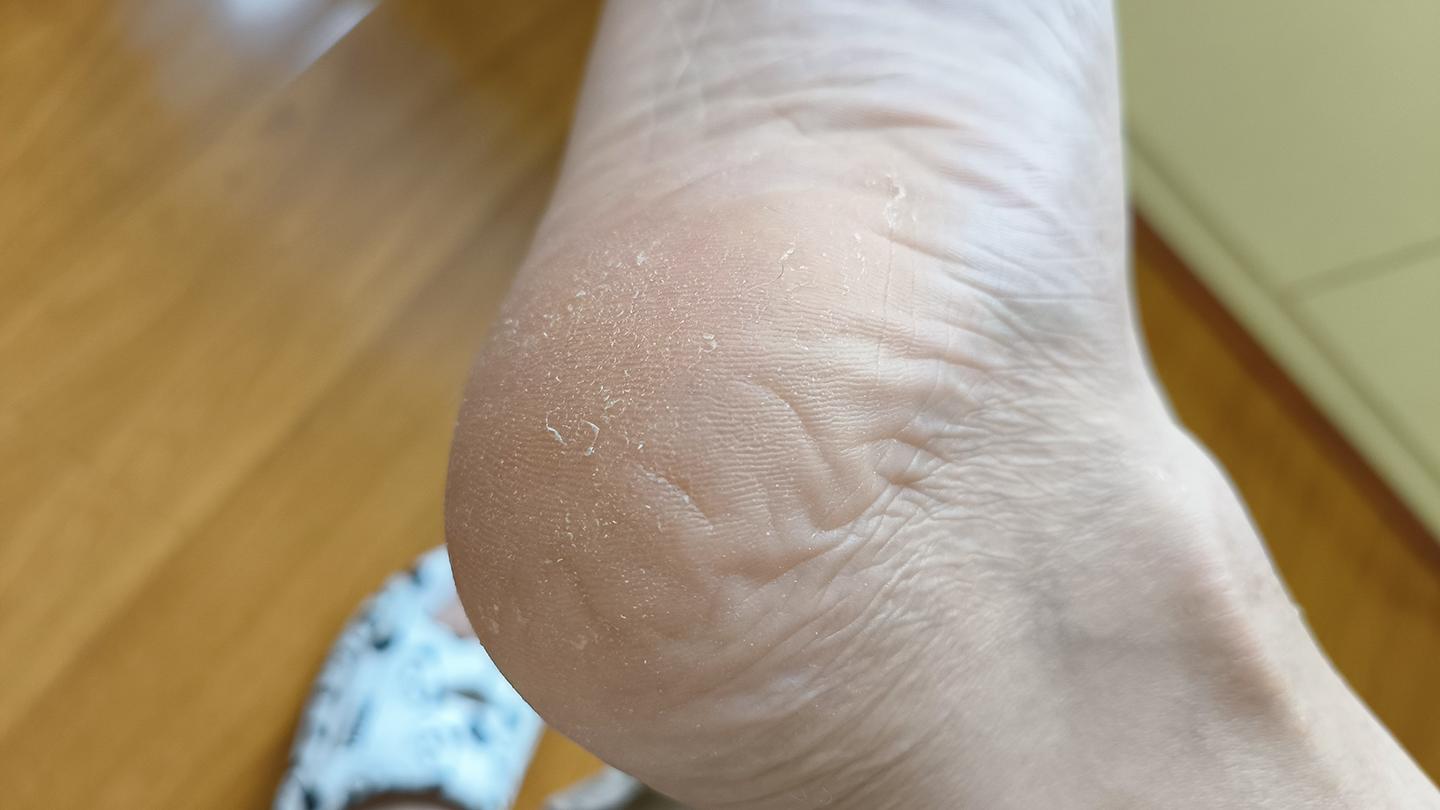 有了它终于不用当抠脚大汉了——DOCO电动修足器