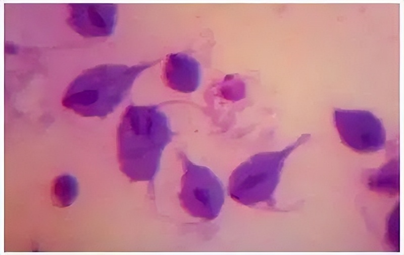 六类疾病可以通过性传播，医生劝告：思想开放的人，别胡作非为！