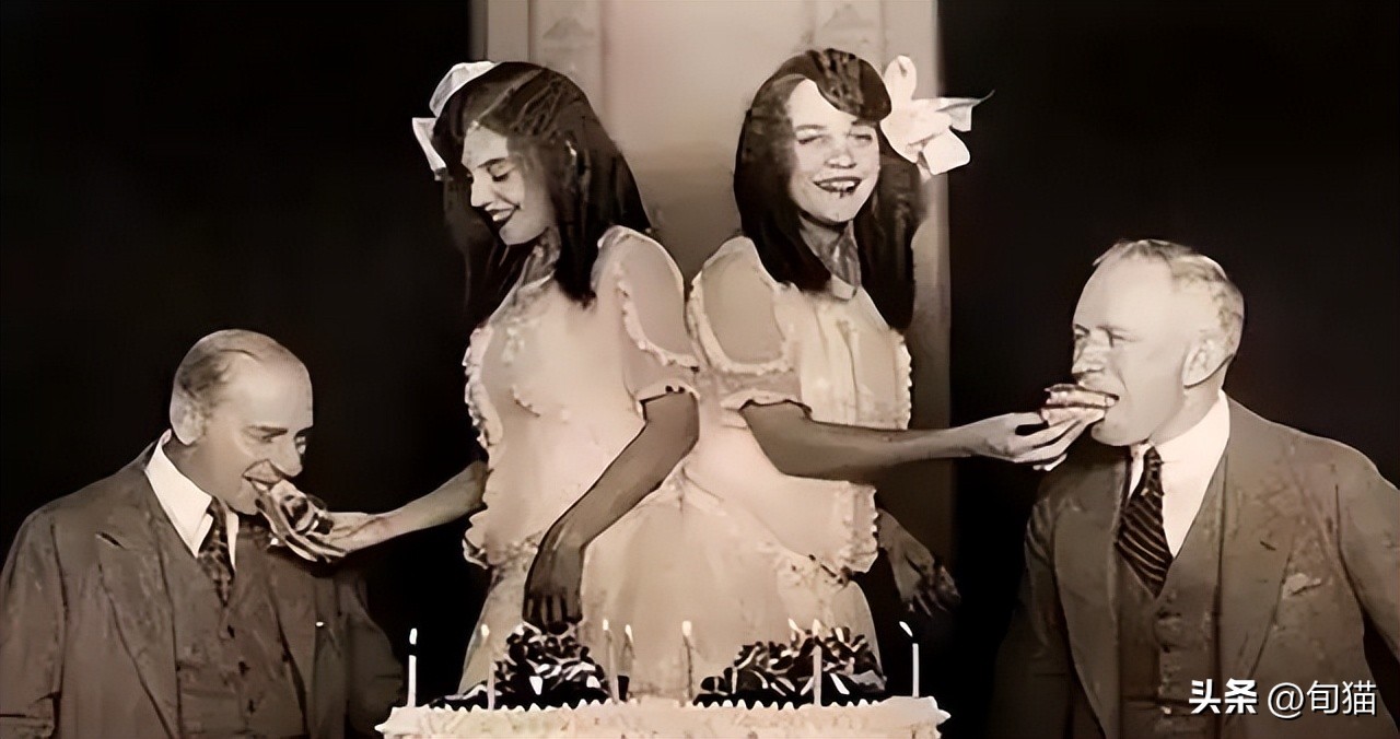 连体姐姐死亡原因,姐妹连体手术分离姐姐去世