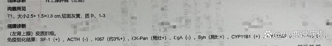 临床诊断肾上腺良性肿瘤怎么办,体检时出现肾上腺肿瘤怎么办