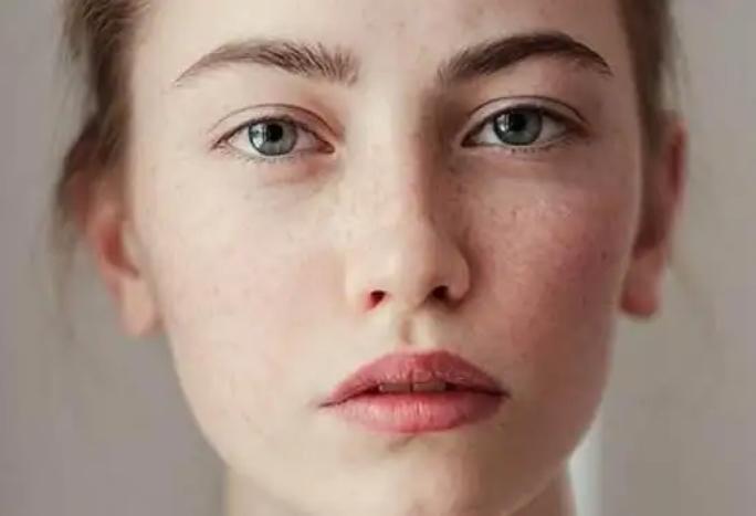 脸上起红斑块用什么草药,脸上起斑块中医如何调理